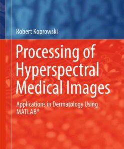 Processing of Hyperspectral Medical Images: Applications in Dermatology Using Matlab® eBook