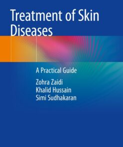 Treatment of Skin Diseases: A Practical Guide eBook