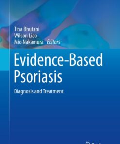 Evidence-Based Psoriasis: Diagnosis and Treatment eBook