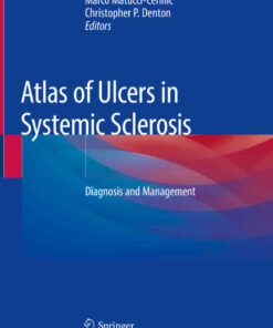 Atlas of Ulcers in Systemic Sclerosis: Diagnosis and Management eBook