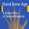 Hand Bone Age: A Digital Atlas of Skeletal Maturity eBook