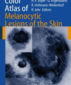 Color Atlas of Melanocytic Lesions of the Skin eBook