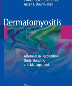 Dermatomyositis: Advances in Recognition, Understanding and Management eBook