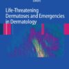 Life-Threatening Dermatoses and Emergencies in Dermatology eBook