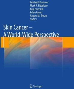 Skin Cancer - A World-Wide Perspective eBook