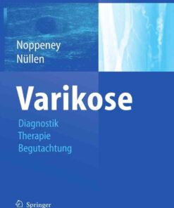 Varikose: Diagnostik - Therapie - Begutachtung eBook
