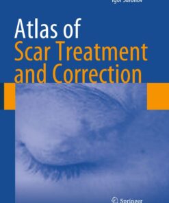 Atlas of Scar Treatment and Correction eBook