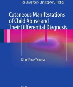 Cutaneous Manifestations of Child Abuse and Their Differential Diagnosis: Blunt Force Trauma eBook