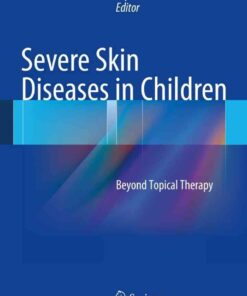 Severe Skin Diseases in Children: Beyond Topical Therapy eBook