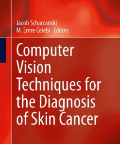 Computer Vision Techniques for the Diagnosis of Skin Cancer eBook