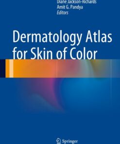 Dermatology Atlas for Skin of Color eBook