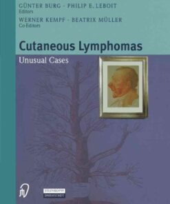 Cutaneous Lymphomas: Unusual Cases eBook