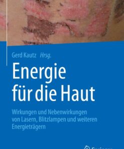 Energie für die Haut: Wirkungen und Nebenwirkungen von Lasern, Blitzlampen und weiteren Energieträgern eBook