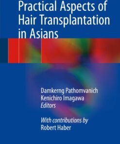 Practical Aspects of Hair Transplantation in Asians eBook