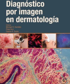 Diagnóstico por imagen en dermatología eBook
