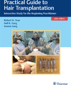 Practical Guide to Hair Transplantation: Interactive Study for the Beginning Practitioner eBook