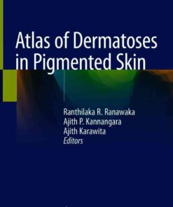Atlas of Dermatoses in Pigmented Skin eBook