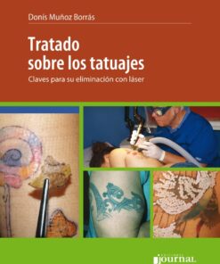 Tratado sobre los tatuajes: Claves sobre su eliminación con láser eBook
