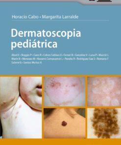 Dermatoscopia pediátrica eBook