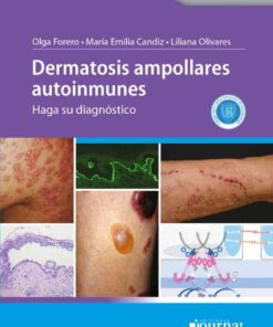 Dermatosis ampollares autoinmunes eBook