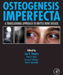 Osteogenesis Imperfecta: A Translational Approach to Brittle Bone Disease eBook