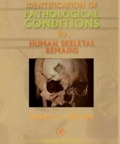 Identification of Patholog in Human Skeletal Remains eBook