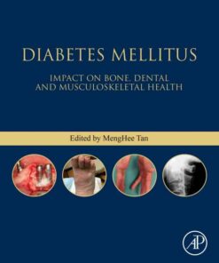 Diabetes Mellitus: Impact on Bone, Dental and Musculoskeletal Health eBook