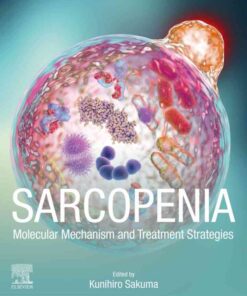 Sarcopenia: Molecular Mechanism and Treatment Strategies eBook