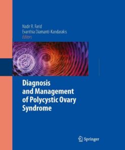 Diagnosis and Management of Polycystic Ovary Syndrome eBook