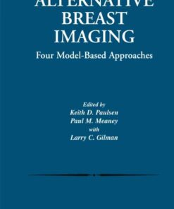 Alternative Breast Imaging: Four Model-Based Approaches eBook
