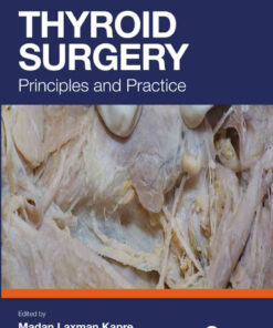 Thyroid Surgery: Principles and Practice eBook