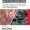Endometriosis: Current Topics in Diagnosis and Management eBook