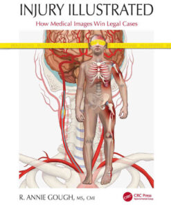 Injury Illustrated: How Medical Images Win Legal Cases eBook