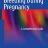Bleeding During Pregnancy: A Comprehensive Guide eBook