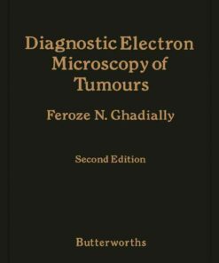 Diagnostic Electron Microscopy of Tumours eBook