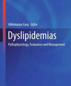 Dyslipidemias: Pathophysiology, Evaluation and Management eBook