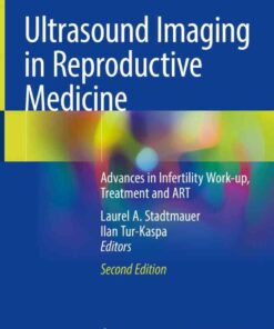 Ultrasound Imaging in Reproductive Medicine: Advances in Infertility Work-up, Treatment and ART eBook
