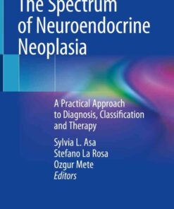 The Spectrum of Neuroendocrine Neoplasia: A Practical Approach to Diagnosis, Classification and Therapy eBook