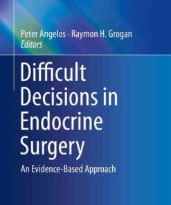 Difficult Decisions in Endocrine Surgery: An Evidence-Based Approach eBook