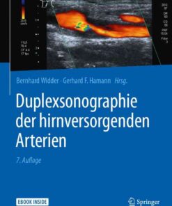 Duplexsonographie der hirnversorgenden Arterien eBook