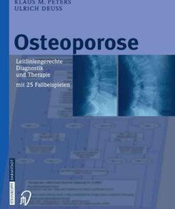 Osteoporose: Leitliniengerechte Diagnostik und Therapie mit 25 Fallbeispielen eBook