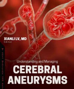 Understanding and Managing Cerebral Aneurysms eBook