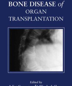 Bone Disease of Organ Transplantation eBook