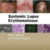 Systemic Lupus Erythematosus: Basic, Applied and Clinical Aspects eBook