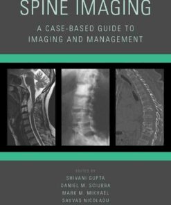 Spine Imaging: A Case-Based Guide to Imaging and Management, 1st Edition eBook