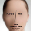 Face/On: Face Transplants and the Ethics of the Other, 1st Edition eBook