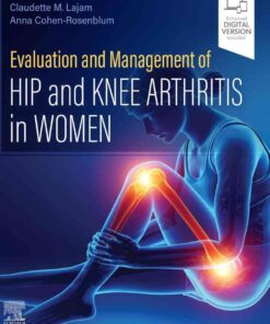 Evaluation and Management of Hip and Knee Arthritis in Women eBook
