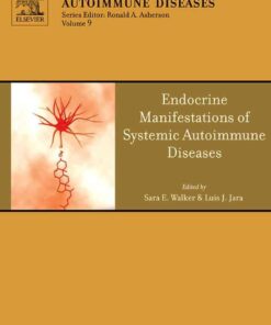 Endocrine Manifestations of Systemic Autoimmune Diseases