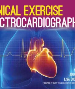 Clinical Exercise Electrocardiography, 1st Edition eBook