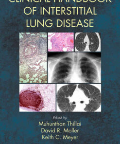 Clinical Handbook of Interstitial Lung Disease, 1st Edition eBook